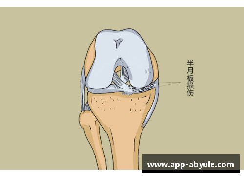 足球星辰的韧性之旅 半月板损伤如何改变了他们的职业生涯